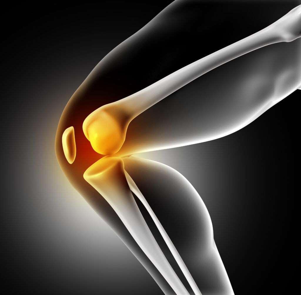knee pain 5 Golf Injuries You Can Avoid